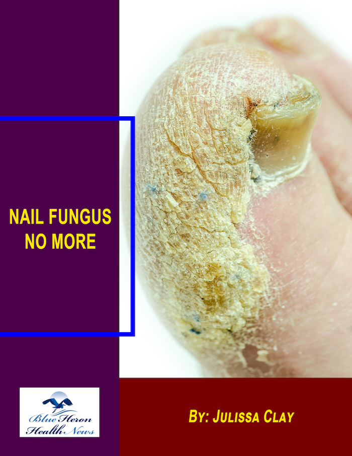 NailFungusCover_smaller