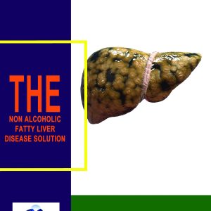 The Non-Alcoholic Fatty Liver Disease Solution - Printed