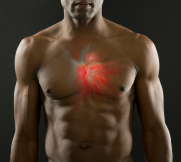 High Cholesterol Linked to Psoriasis