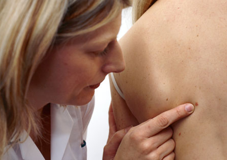 Can High Blood Pressure Cause Cancer?