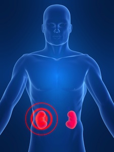 Popular Blood Pressure Meds Cause Kidney Failure- and Even Death