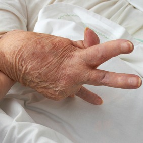 Curing Genetic Arthritis Risk Naturally