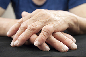 How Arthritis Turns Deadly (scary, but important to know)