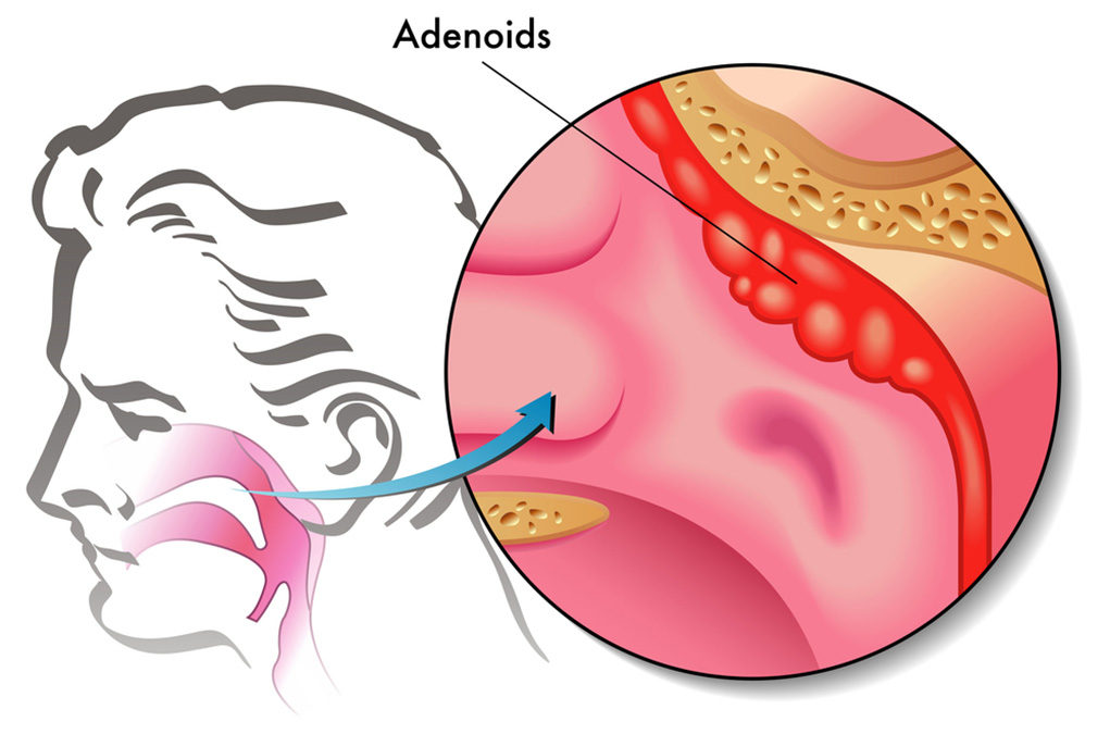 When Snoring and Sleep Apnea Is Out Of Your Control