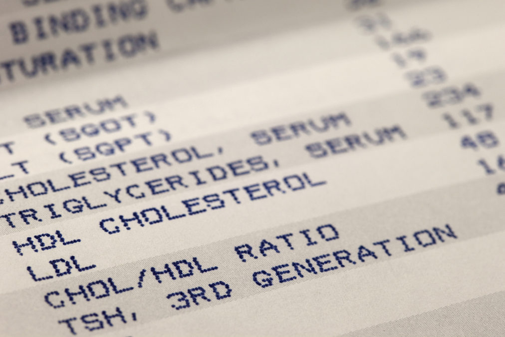 When Good Cholesterol Causes Heart Attack
