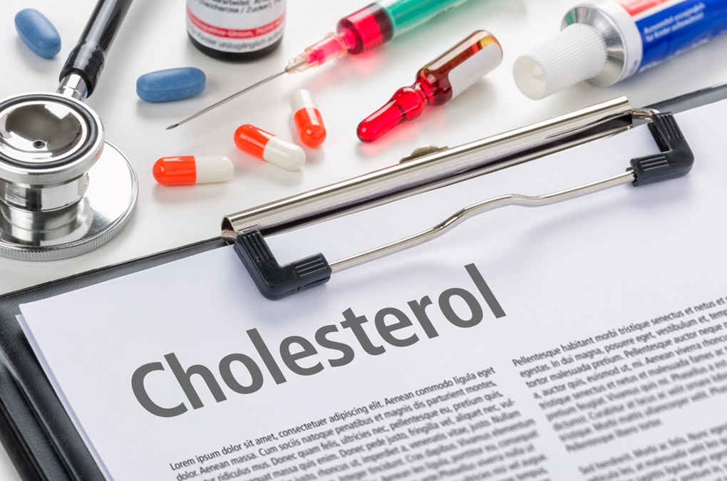 Lowering Cholesterol INCREASES Stroke Risk 220%