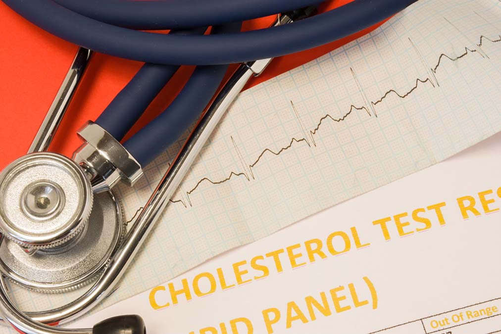 Cholesterol and Red Meat (A Shocking Study)