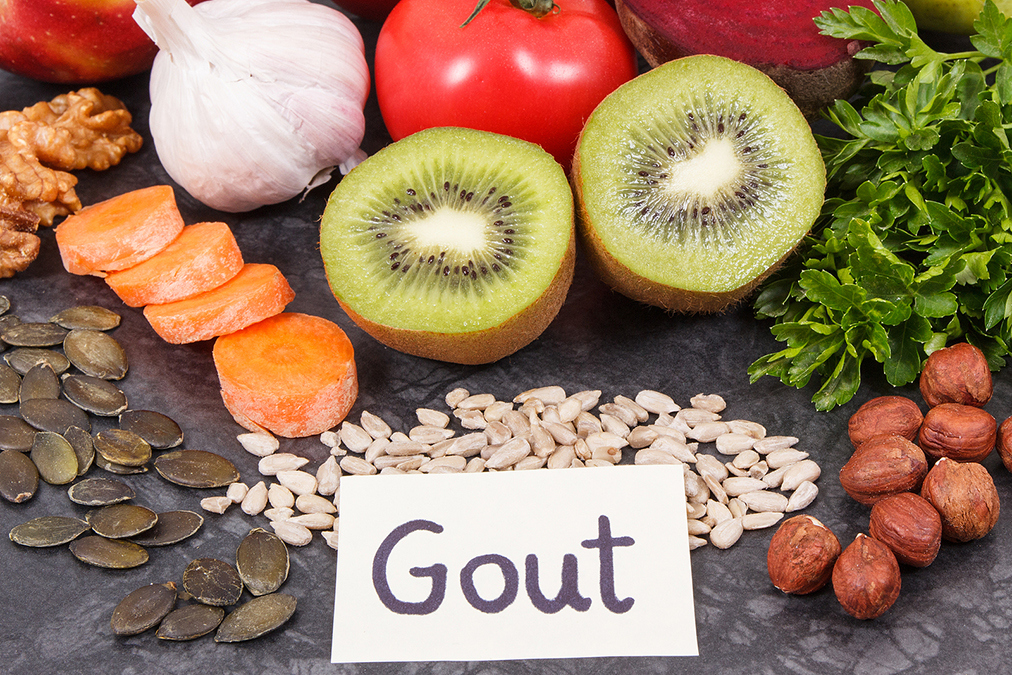 Gout And Weight; Weird Connection