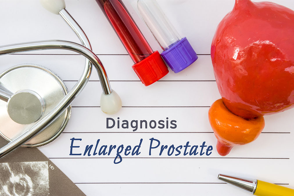 Enlarged Prostate’s Weird Effect