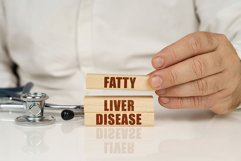 How Fatty Liver Disease Stops You From Exercising (and what to do about it)