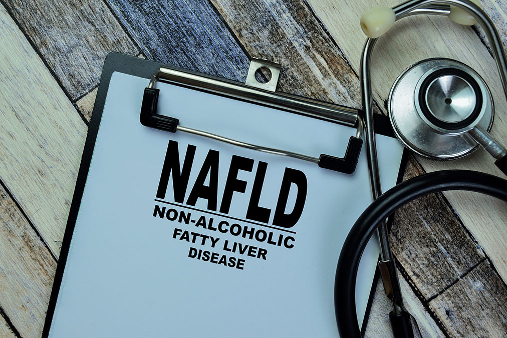 Changing Country Heals Nonalcoholic Fatty Liver Disease