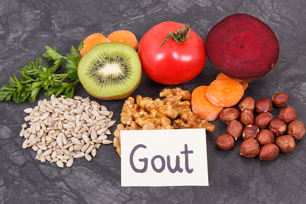 Enlarged Prostate or Gout–Your Choice