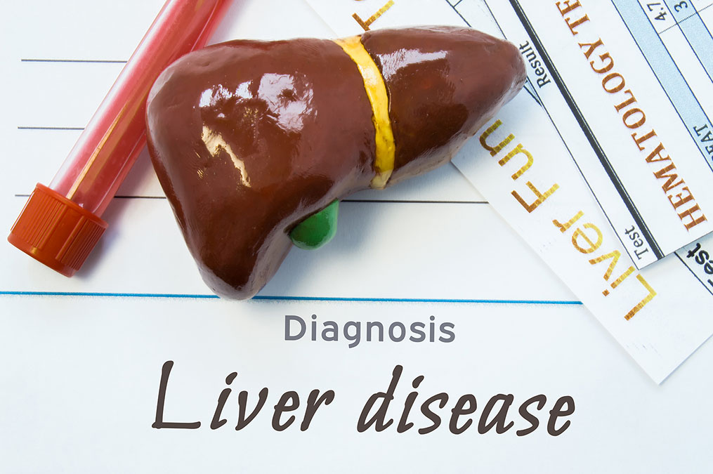 Healing Nonalcoholic Fatty Liver Disease: not what but when