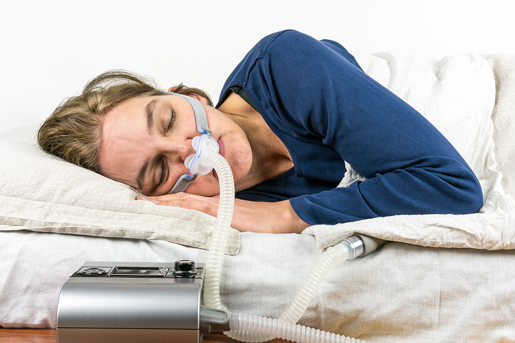 Sleep Apnea is not caused by Obesity alone