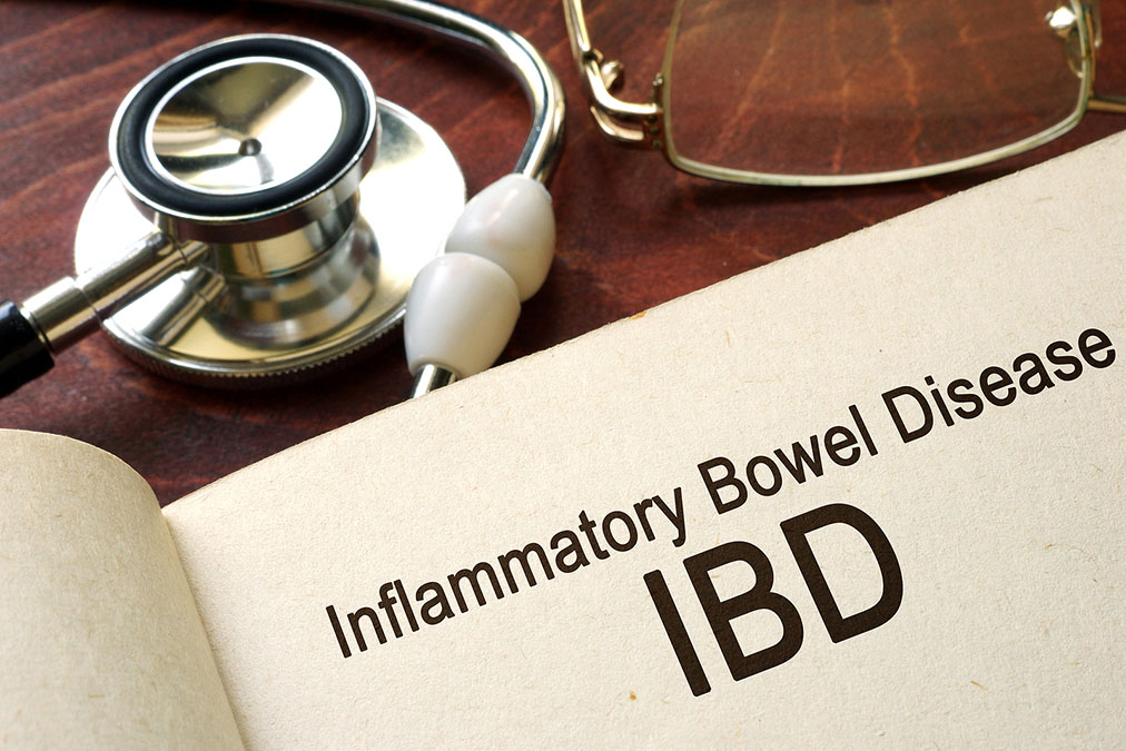 IBD and Hemorrhoids connection