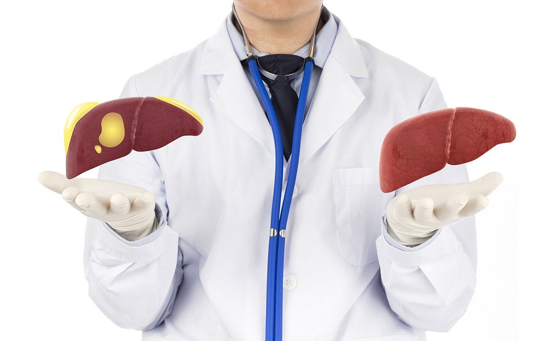 Weird Fatty Liver and sleep connection discovered