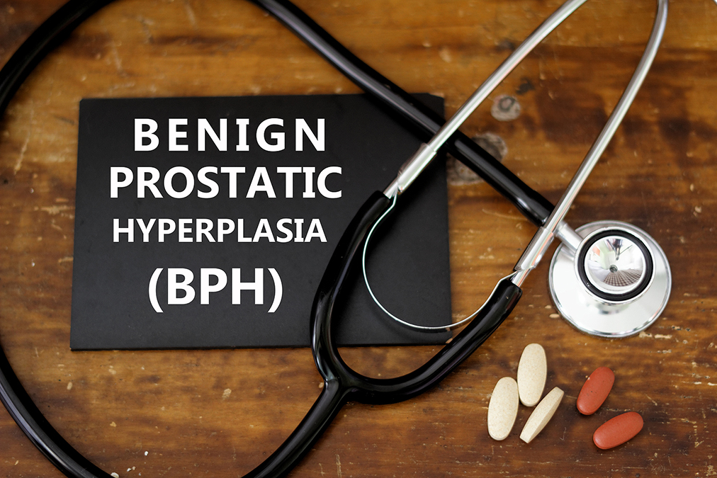 Enlarged Prostate? Check This One Number