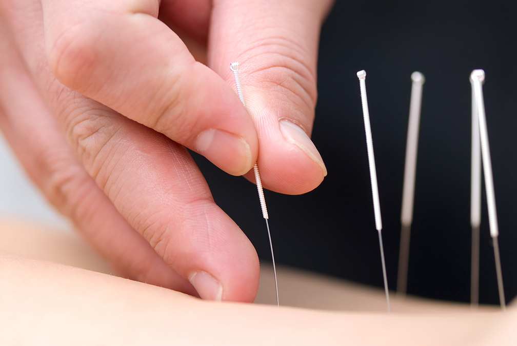 Stab Neuropathy stabbing pain away