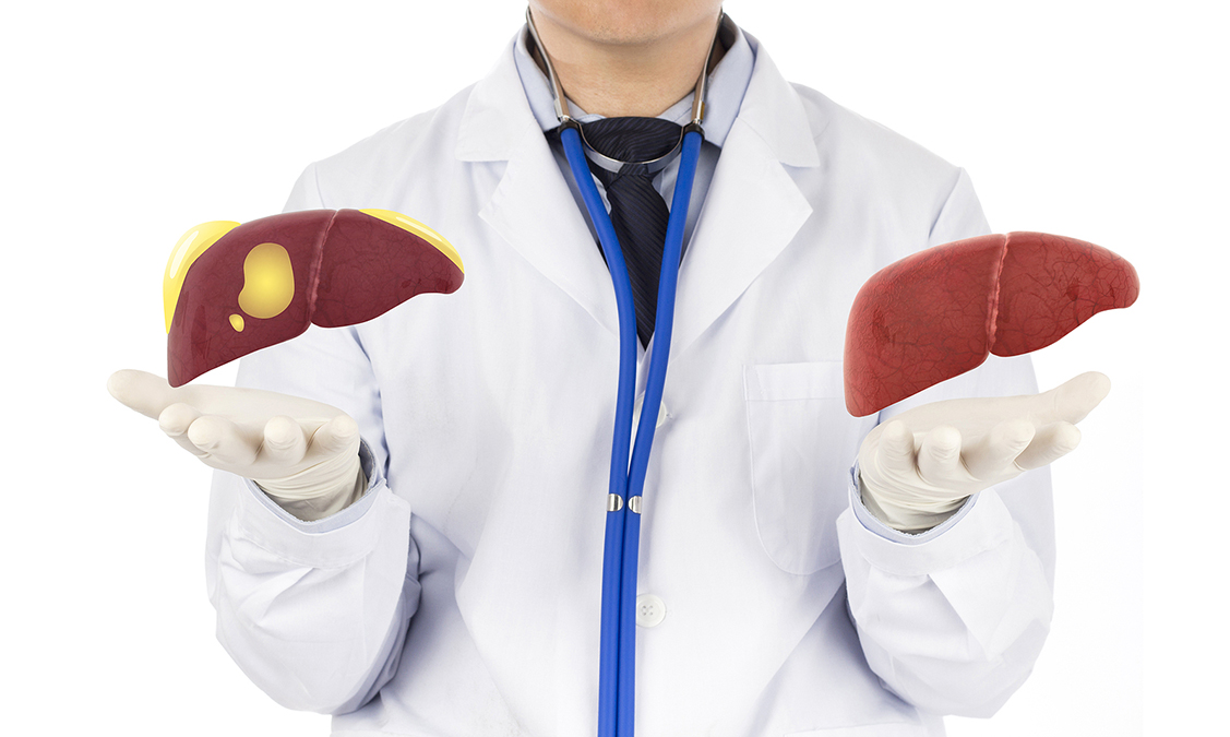 The good news about Fatty Liver Disease